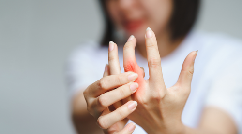 When Can I Expect To See Changes In My Arthritis From Taking Collagen Supplements?