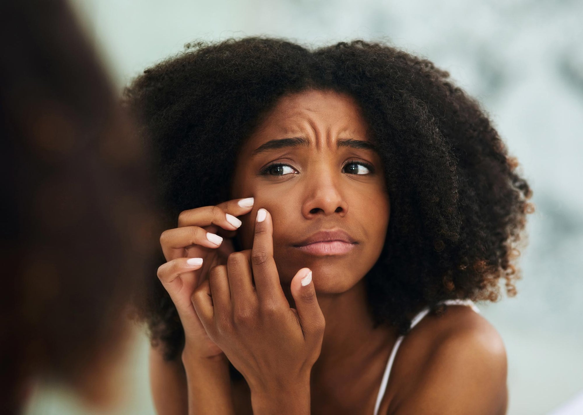 Does Collagen Help Acne?